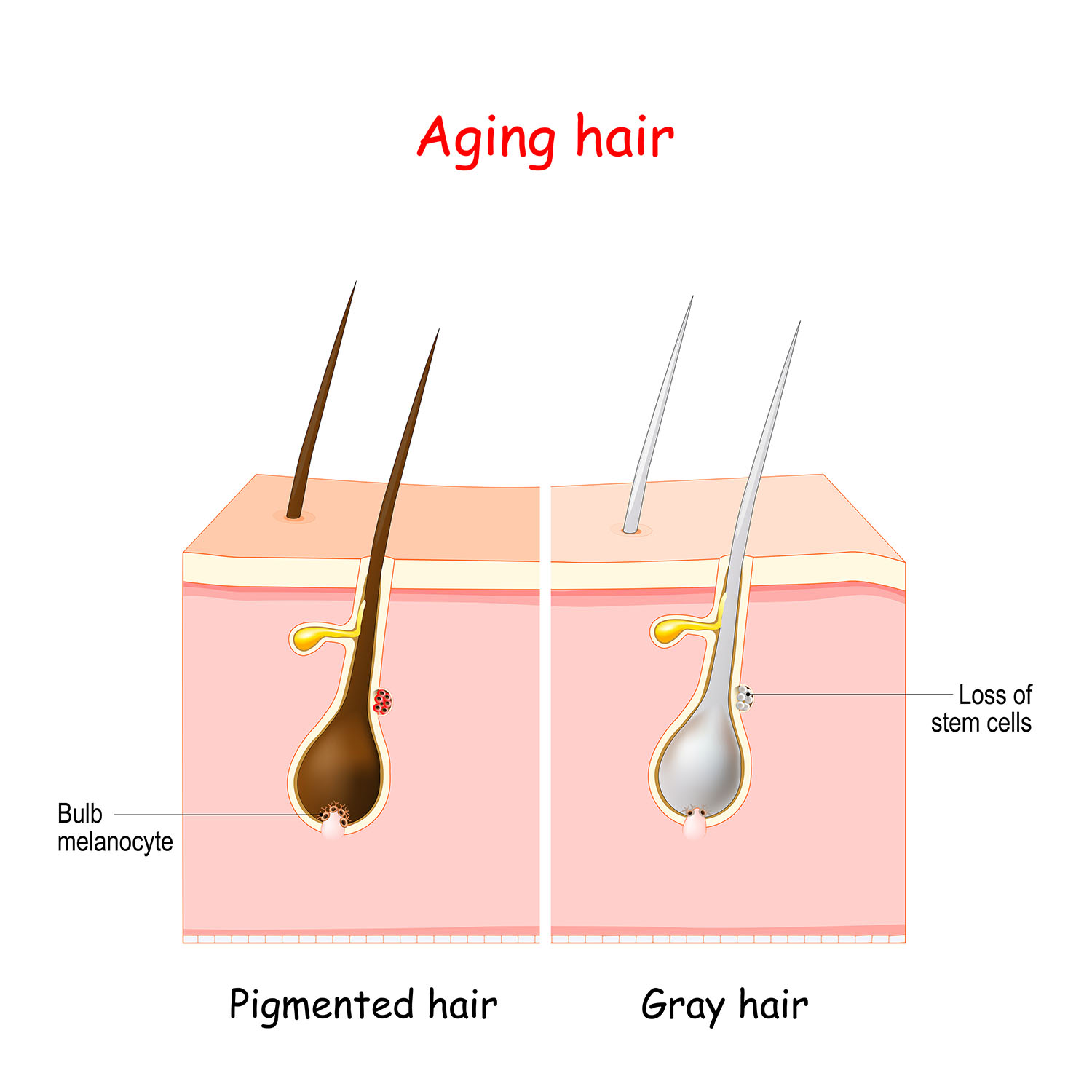 白髪の原因と身近でできる白髪対策、予防方法
